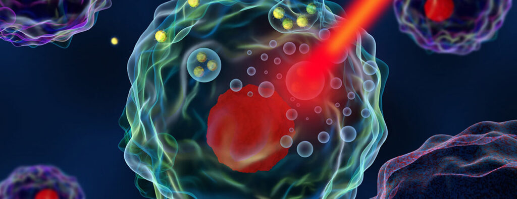 Hipertermija – Suvremena integrativna terapija za tumore i kronične bolesti